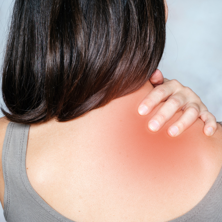 woman rubs sore neck/shoulder area that is red